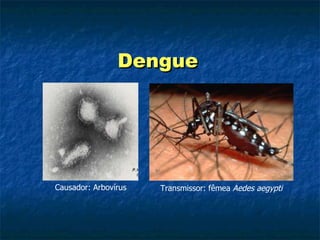 Dengue Transmissor: fêmea  Aedes aegypti Causador: Arbovírus 