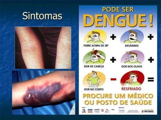 Sintomas 