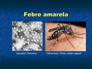 Febre amarela Causador: Flavivírus Transmissor: fêmea  Aedes aegypti 