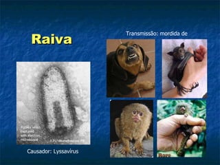 Raiva   Causador: Lyssavírus Transmissão: mordida de 