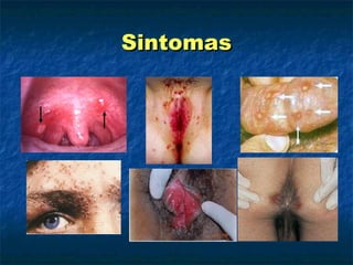 Sintomas 