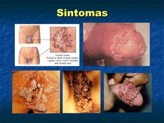 Sintomas 