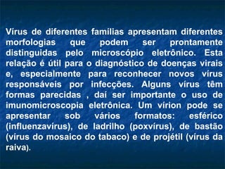 Vírus de diferentes famílias apresentam diferentes morfologias que podem ser prontamente distinguidas pelo microscópio eletrônico. Esta relação é útil para o diagnóstico de doenças virais e, especialmente para reconhecer novos vírus responsáveis por infecções. Alguns vírus têm formas parecidas , daí ser importante o uso de imunomicroscopia eletrônica. Um vírion pode se apresentar sob vários formatos: esférico (influenzavírus), de ladrilho (poxvírus), de bastão (vírus do mosaico do tabaco) e de projétil (vírus da raiva ). 
