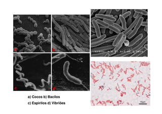 a) Cocos b) Bacilos
c) Espirilos d) Vibriões
 