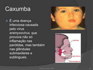 Caxumba
 É uma doença
infecciosa causada
pelo vírus
aramyxovirus, que
provoca não só
inflamação nas
parótidas, mas também
nas glândulas
submaxilares e
sublinguais.
Ciências Naturais - ICRM 23
 