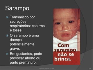 Sarampo
 Transmitido por
secreções
respiratórias: espirros
e tosse.
 O sarampo é uma
doença
potencialmente
grave.
 Em gestantes, pode
provocar aborto ou
parto prematuro.
Ciências Naturais - ICRM 28
 