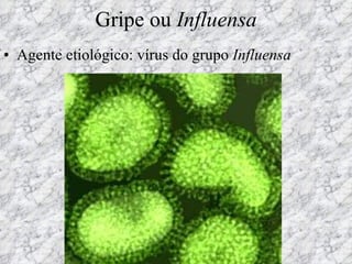 Gripe ou  Influensa Agente etiológico: vírus do grupo  Influensa 