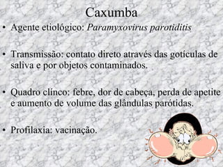 Caxumba Agente etiológico:  Paramyxovirus parotiditis Transmissão: contato direto através das gotículas de saliva e por objetos contaminados. Quadro clínco: febre, dor de cabeça, perda de apetite e aumento de volume das glândulas parótidas. Profilaxia: vacinação. 