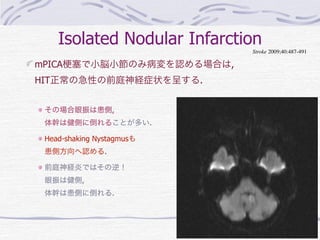 めまい 中枢 Vs 末梢 | PDF
