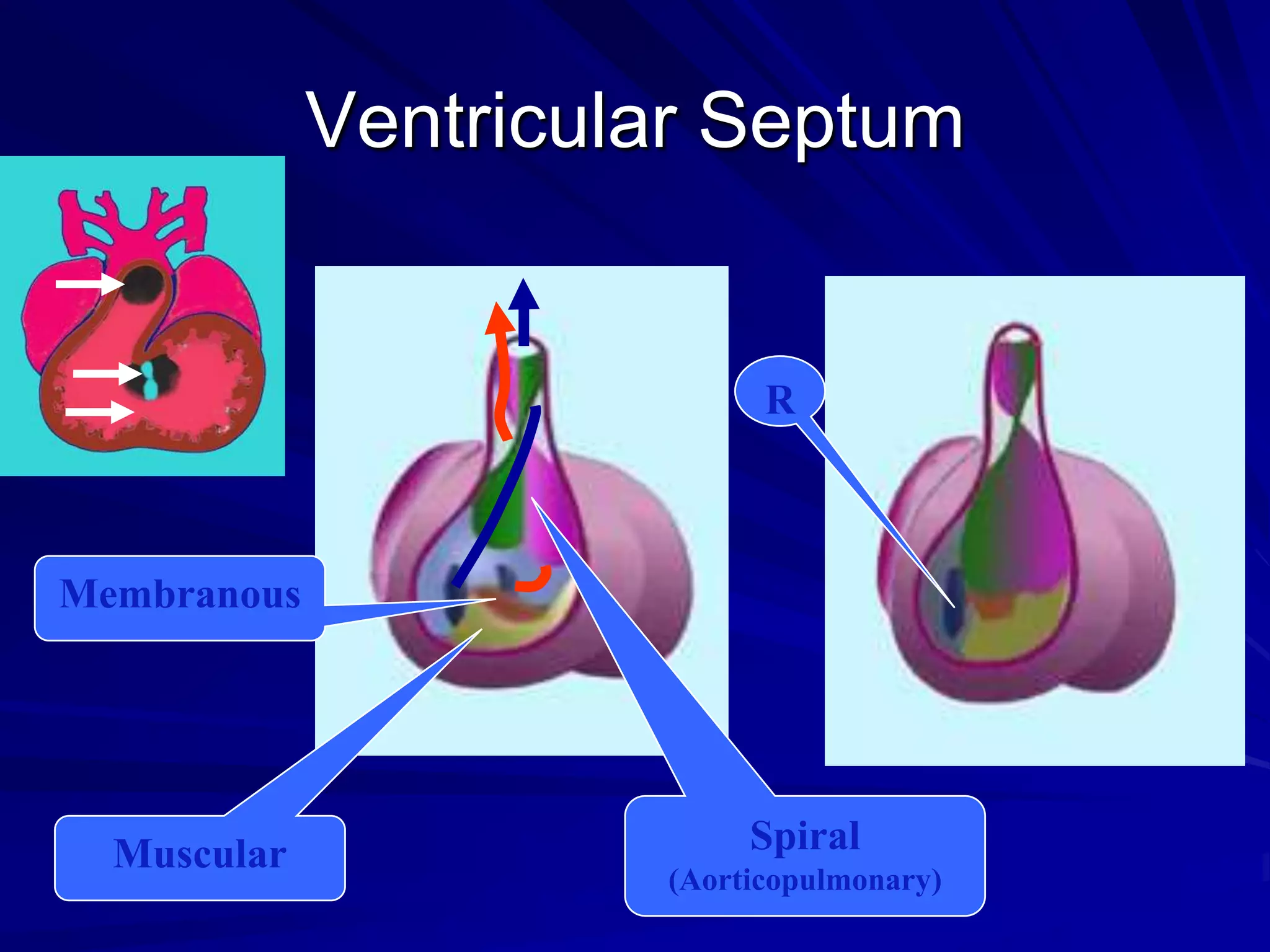 Ventricular Septum

R

Membranous

Muscular

Spiral
(Aorticopulmonary)

 
