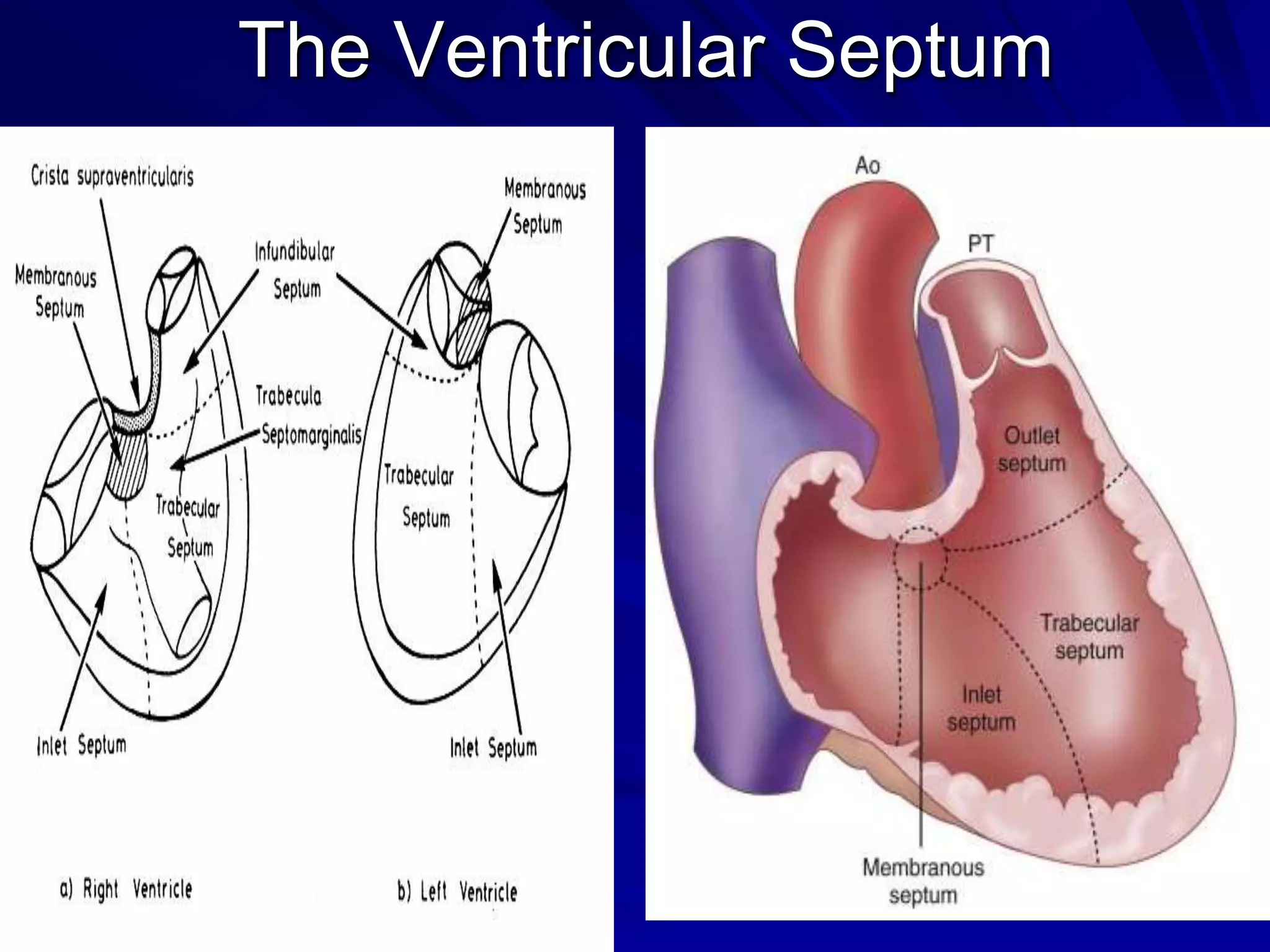 The Ventricular Septum

 