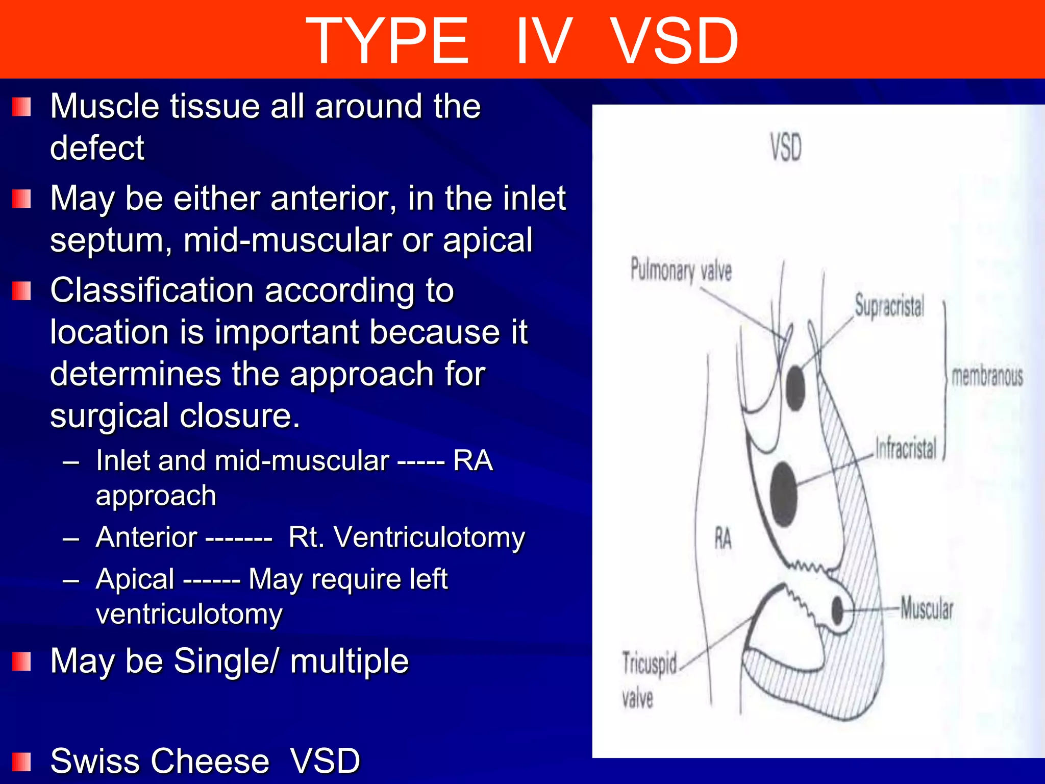 TYPE IV VSD
Muscle tissue all around the
defect
May be either anterior, in the inlet
septum, mid-muscular or apical
Classification according to
location is important because it
determines the approach for
surgical closure.
– Inlet and mid-muscular ----- RA
approach
– Anterior ------- Rt. Ventriculotomy
– Apical ------ May require left
ventriculotomy

May be Single/ multiple
Swiss Cheese VSD

 