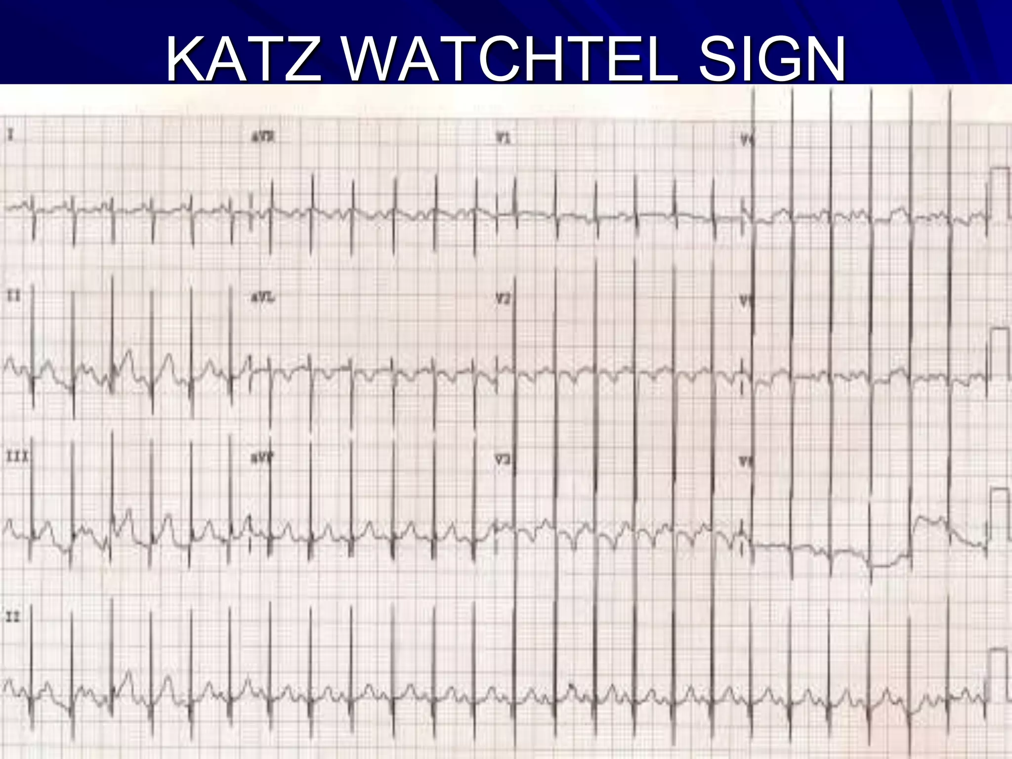 KATZ WATCHTEL SIGN

 