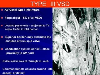 Vsd | PPTX