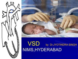 VSD

by Dr.JYOTINDRA SINGH

NIMS,HYDERABAD

 