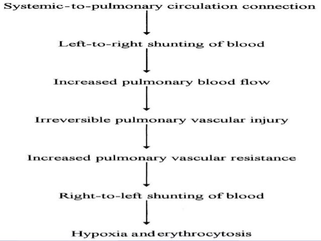 Pathophysiology Of Ventricular Septal Defect In Flow Chart