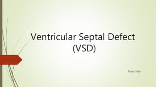 Ventricular Septal Defect
(VSD)
Meru Yale
 