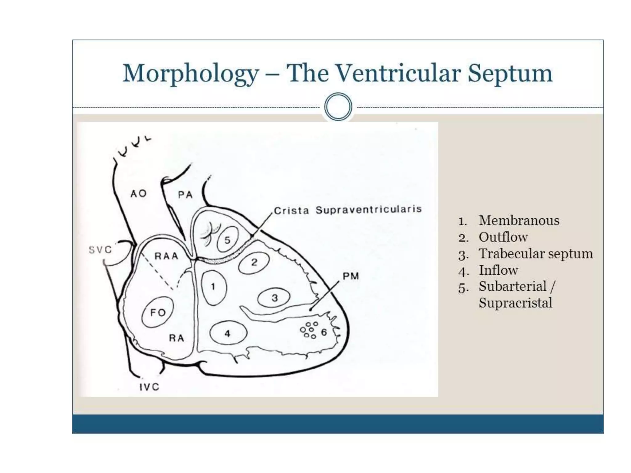 Ventricular Septal defects Echocardiography | PPTX