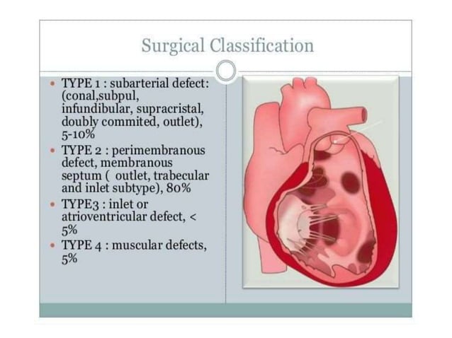 Ventricular Septal defects Echocardiography | PPTX | Heart and ...