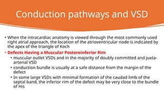 Ventricular Septal Defect (VSD) – Classification, Clinical Features ...