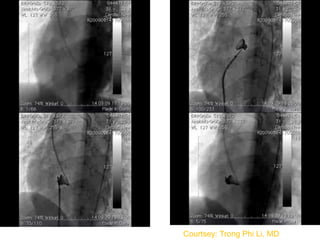 Courtsey: Trong Phi Li, MD
 