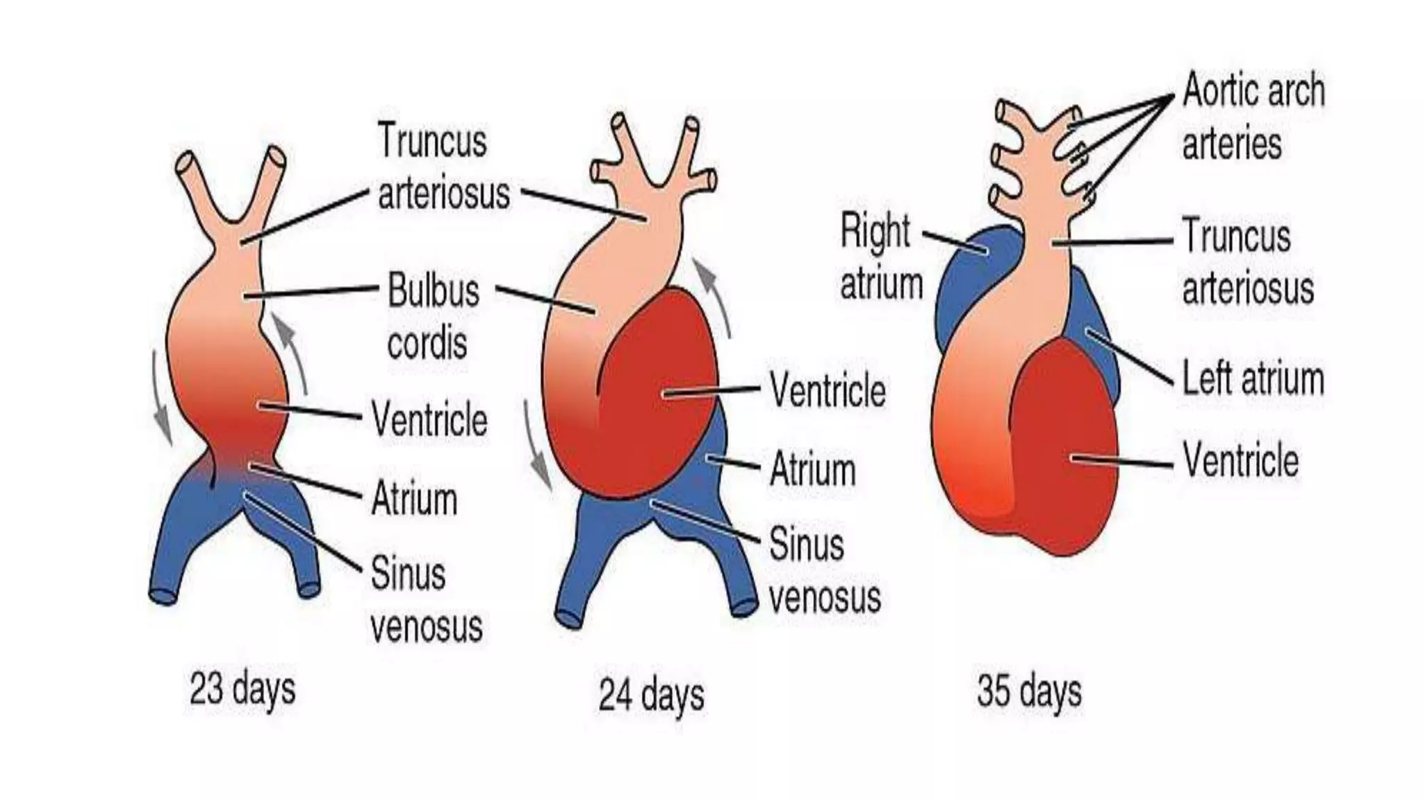 Ventricular Septal Defects | PPTX