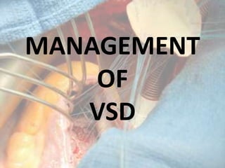 MANAGEMENT
OF
VSD
 