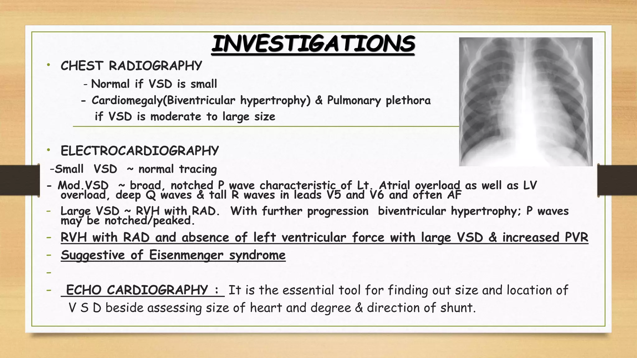 INVESTIGATIONS
• CHEST RADIOGRAPHY
- Normal if VSD is small
- Cardiomegaly(Biventricular hypertrophy) & Pulmonary plethora
if VSD is moderate to large size
• ELECTROCARDIOGRAPHY
-Small VSD ~ normal tracing
- Mod.VSD ~ broad, notched P wave characteristic of Lt. Atrial overload as well as LV
overload, deep Q waves & tall R waves in leads V5 and V6 and often AF
- Large VSD ~ RVH with RAD. With further progression biventricular hypertrophy; P waves
may be notched/peaked.
- RVH with RAD and absence of left ventricular force with large VSD & increased PVR
- Suggestive of Eisenmenger syndrome
-
- ECHO CARDIOGRAPHY : It is the essential tool for finding out size and location of
V S D beside assessing size of heart and degree & direction of shunt.
 