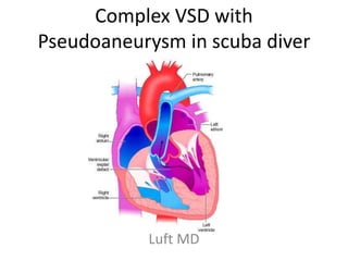 Complex VSD with
Pseudoaneurysm in scuba diver
Luft MD
 