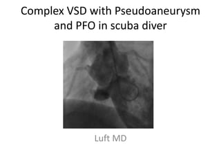 Complex VSD with Pseudoaneurysm
and PFO in scuba diver
Luft MD
 