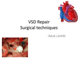 VSD Repair
Surgical techniques
-RAJA LAHIRI
 