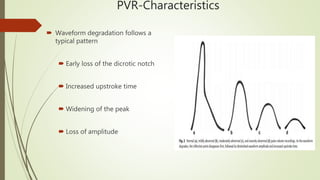 Vascular Laboratory: Arterial Physiologic Assessment & Arterial Duplex ...