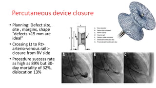 Percutaneous device closure
• Planning: Defect size,
site , margins, shape
“defects <15 mm are
ideal”
• Crossing Lt to Rt>
arterio-venous rail >
closure from RV side
• Procedure success rate
as high as 89% but 30-
day mortality of 32%,
dislocation 13%
 