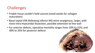 Challenges
• Friable tissue couldn’t hold sutures (need weeks for collagen
maturation)
• Basal septal VSR (following Inferior MI) more serpiginous, larger, with
more intra-myocardial dissection, possible extension to free wall
• For anterior defects, operative mortality ranges from 10% to 15%; and
30% to 35% for posterior defects
 