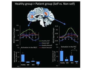 fMRI Results
 