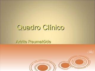 Quadro ClínicoQuadro Clínico
Artrite ReumatóideArtrite Reumatóide
 
