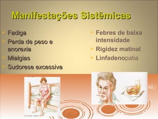 Manifestações SistêmicasManifestações Sistêmicas
 FadigaFadiga
 Perda de peso ePerda de peso e
anorexiaanorexia
 MialgiasMialgias
 Sudorese excessivaSudorese excessiva
 Febres de baixa
intensidade
 Rigidez matinal
 Linfadenopatia
 