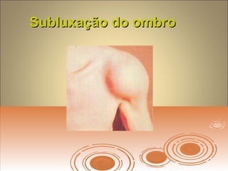 Subluxação do ombroSubluxação do ombro
 