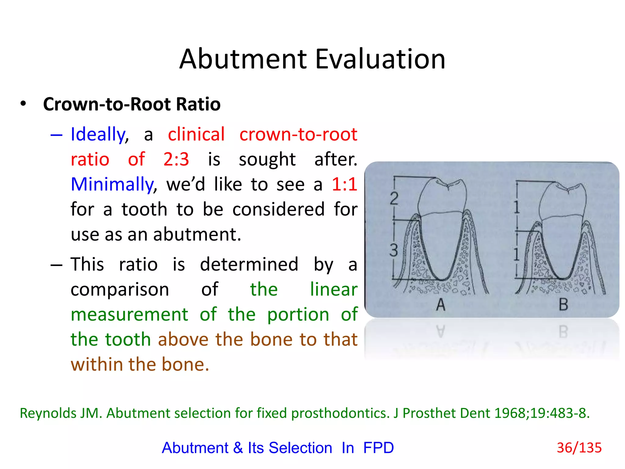 Abutment & Its Selection In Fixed Partial Denture | PPTX