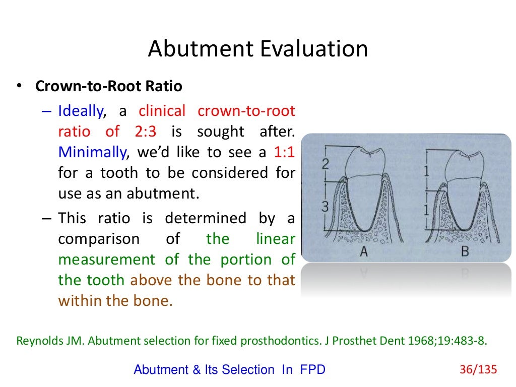 Abutment & Its Selection In Fixed Partial Denture