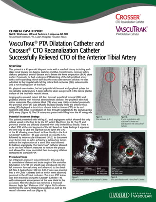 VascuTrak® 
PTA Dilatation Catheter 
CLINICAL CASE REPORT 
Neil E. Strickman, MD and Federico E. Azpurua-Gil, MD 
Texas Heart Institute / St. Luke’s Hospital, Houston Texas 
VascuTrak® PTA Dilatation Catheter and 
Crosser® CTO Recanalization Catheter 
Successfully Relieved CTO of the Anterior Tibial Artery 
Overview 
This patient is a 47-year-old Hispanic male with a medical history including end-stage 
renal disease on dialysis, diabetes mellitus, hypertension, coronary artery 
disease, peripheral arterial disease and a below the knee amputation (BKA) years 
earlier. Previously, he had undergone PTA/stenting of the left popliteal artery 
with a self-expanding nitinol stent but the exact date remains unclear. He was 
admitted to the hospital with left leg critical limb ischemia (CLI), osteomyelitis 
and a non-healing ulcer of that foot. 
On physical examination, he had palpable left femoral and popliteal pulses but 
no palpable pedal pulses. A large ischemic ulcer was present in the lateral plantar 
surface of the foot with necrotic tissue. 
Angiography revealed patent left iliac, femoral, superficial femoral (SFA) and 
popliteal arteries with minimal atherosclerotic disease. The popliteal stent had 
minor restenosis. The posterior tibial (PT) artery was 100% occluded proximally; 
the peroneal artery (P) was diffusely diseased distally while the anterior tibial 
artery (AT) displayed a short 4 cm chronic total occlusion (CTO) in its mid 
segment with distal reconstitution of flow through collaterals to the dorsalis pedis 
(DP) artery (Figure 1). The DP artery was patent with filling from the AT antegrade. 
Potential Treatment Strategy 
This patient presented with left leg CLI and angiograms which showed the only 
arterial vessel in the foot to be the DP, which filled from the AT. The PT and 
peroneal arteries are diffusely diseased with only limited flow distally. There is 
a short CTO at the mid segment of the AT. Based on these findings it appeared 
the only way to save the leg/foot was to open the CTO 
of the AT allowing more blood to flow distally to the foot. 
A Crosser® Catheter 14S was selected to cross the CTO, 
followed by Intravascular Ultrasound (IVUS) to document 
exact lumen size to aid in achieving a satisfactory lumen 
without the implantation of a stent. This was followed 
by balloon angioplasty. The VascuTrak® Catheter allowed 
us to use low inflation pressures to fracture the plaque 
and allowed for more controlled, less damaging inflation 
compared to standard PTA.1 
Procedural Steps 
An antegrade approach was preferred in this case due 
to contralateral disease and acute angle of the aortoiliac 
bifurcation. A 5F/45 cm sheath was introduced into the 
left common femoral artery and advanced to the distal 
left SFA. A hydrophobic 300 cm 0.014" wire was inserted 
into a 4Fr Glide™ catheter, both of which were advanced 
proximal to the AT total occlusion. This 4 cm CTO lesion 
was then traversed using the Crosser® Catheter 14S 
with subsequent advancement of the wire distal to the 
occlusion. After the device was removed a monorail 
Volcano Eagle Eye™ Platinum .014" digital IVUS catheter 
confirmed the wire’s intraluminal position as well as the 
vessel’s diameter and size (Figure 3). 
Figure 2. 
AT post-recanalization with 
a Crosser® Catheter and 
post-dilatation with a VascuTrak® 
Catheter. 
Figure 1. 
Total occlusion of AT 
Area 1 
Area: 2.8mm2 
Max. Diam: 2.2mm 
Min. Diam: 1.6mm 
Difference 
9.5mm2 (77.1%) 
Area 2 
Area: 12.3mm2 
Max. Diam: 4.3mm 
Min. Diam: 3.5mm 
Area 1 
Area: 5.9mm2 
Max. Diam: 2.9mm 
Min. Diam: 2.6mm 
Figure 3. 
IVUS post-recanalization with a Crosser® Catheter 
Figure 4. 
IVUS post-dilatation with a VascuTrak® Catheter 
 