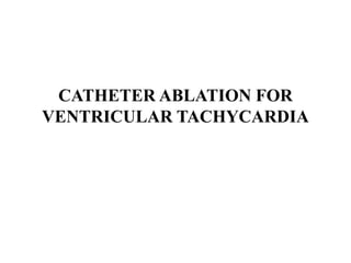 CATHETER ABLATION FOR
VENTRICULAR TACHYCARDIA
 