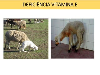 DEFICIÊNCIA VITAMINA E
 