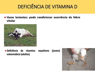 DEFICIÊNCIA DE VITAMINA D
 