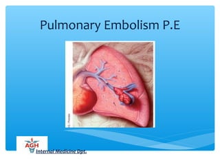 Pulmonary Embolism P.E
Internal Medicine Dpt.
 