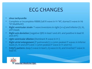 ECG CHANGES
• sinus tachycardia
• Complete or incomplete RBBB (tall R wave in V1 ‘M’; slurred S wave in V6
‘W’;MaRRoW)
• Right ventricular strain- T wave inversions in right (v1-4) and inferior (II, III,
aVF) leads
• Right axis deviation (negative QRS in lead I and aVL and positive in lead III
and aVF)
• right ventricular dilation (Dominant R wave in V1 )
• Right atrial enlargement (P pulmonale) (>2.5mm peaked P waves in inferior
leads (II, III and aVF) and >1.5mm peaked P wave in V1 and V2)
• S1Q3T3 pattern: deep S wave in lead I, Q wave in III, and inverted T wave in
lead III.
Internal Medicine Dpt.
 
