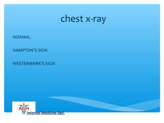 chest x-ray
NORMAL
HAMPTON’S SIGN
WESTERMARK’S SIGN
Internal Medicine Dpt.
 