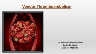 Venous Thromboembolism
Dr. Aditya Ashok Mahankar
Junior Resident
Dept. of Medicine
 