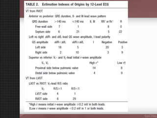 Vt Localization Guide ventricular tachycardia (VT) Localisation | PPT