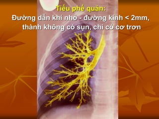 Tiểu phế quản:
Đường dẫn khí nhỏ - đường kính < 2mm,
thành không có sụn, chỉ có cơ trơn
 